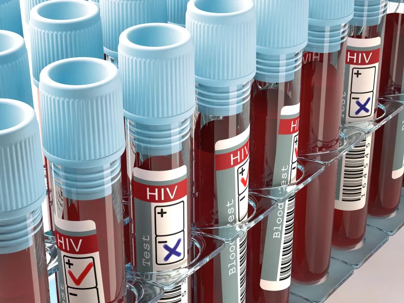 HIV-AIDS-virus